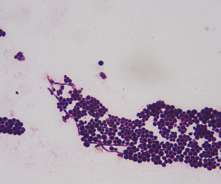 Candida albicans – Ursachen, Symptome und Behandlung