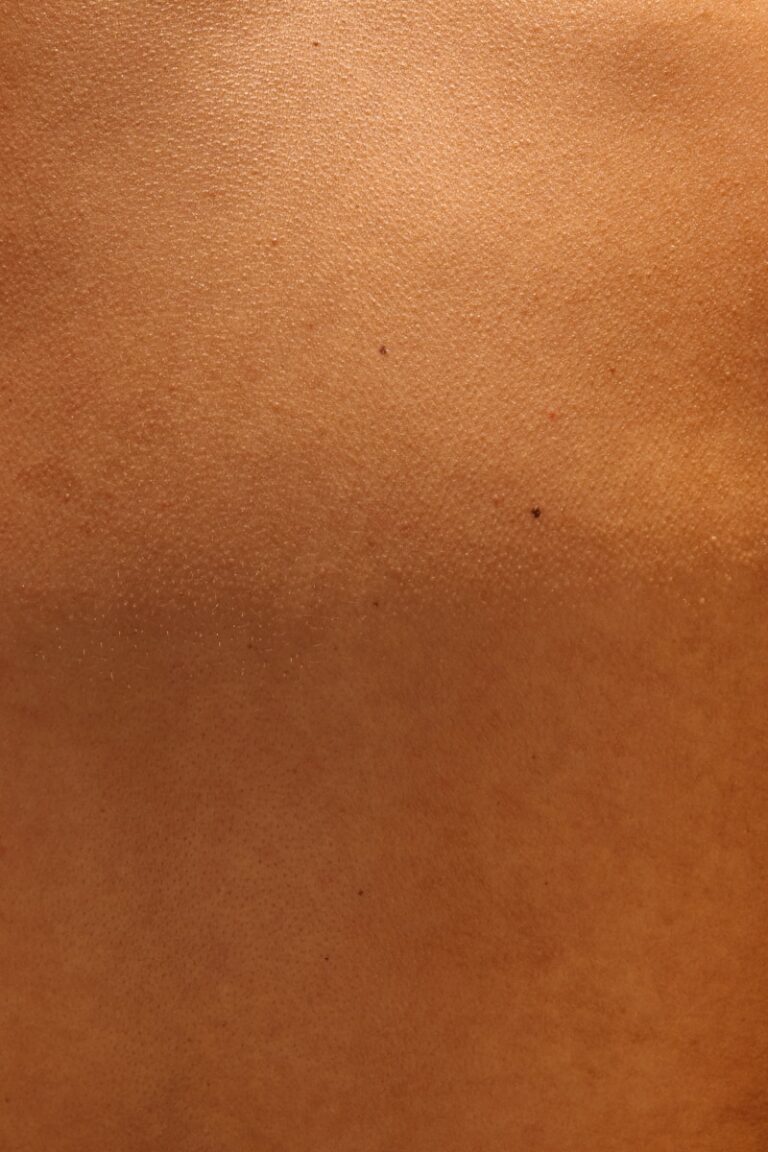 Gürtelrose ohne Bläschen: Wenn der Schmerz unsichtbar bleibt background pattern